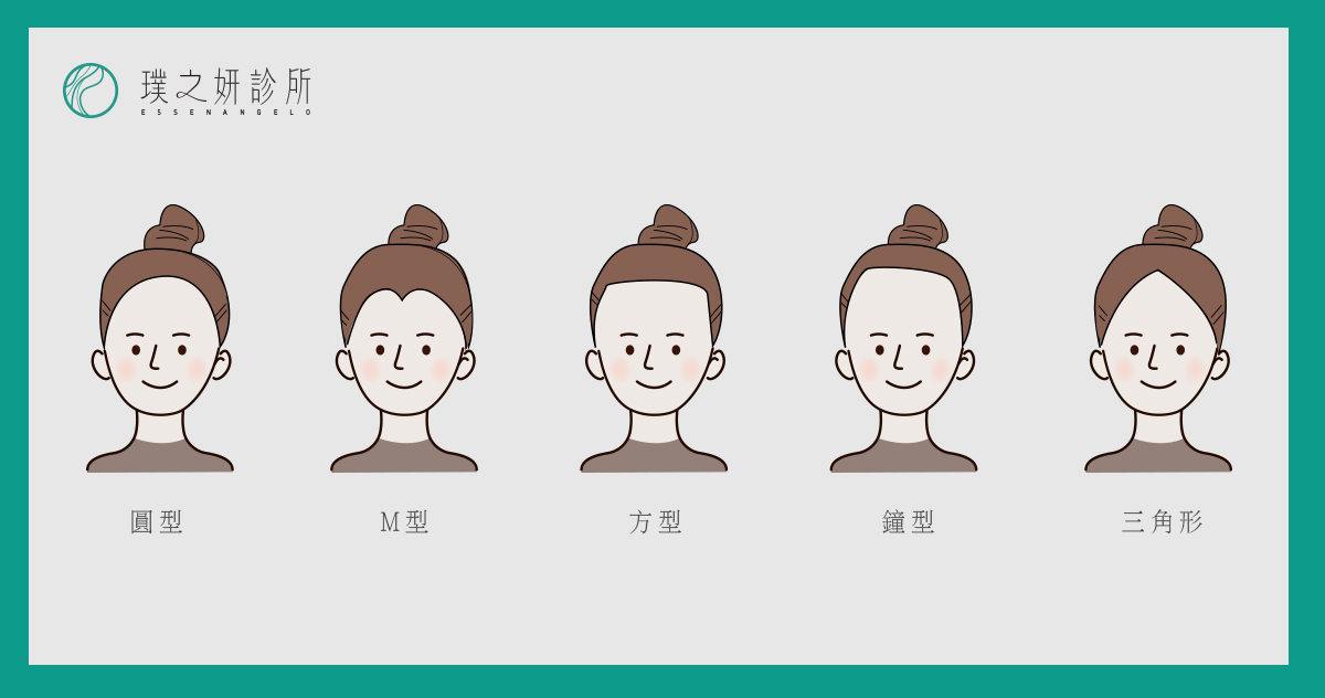 璞之妍湶|女生发际线的五大分类